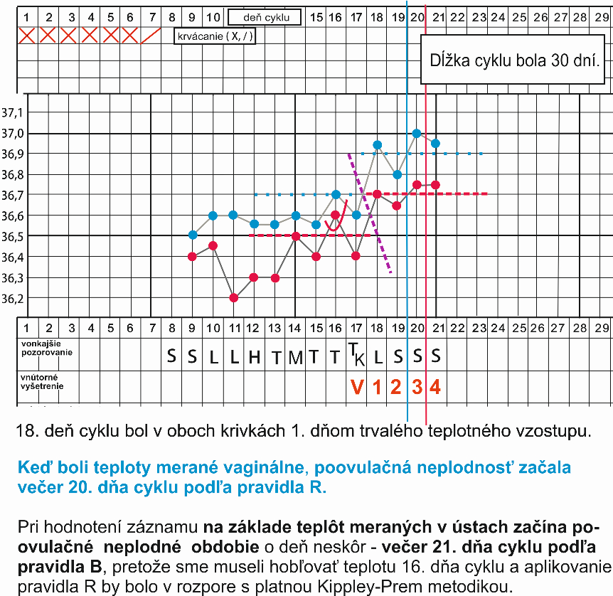 151.5 BT.2