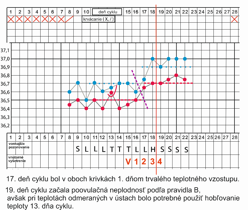 151.5 BT.1.1