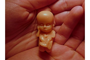 model 12 týždňového počatého dieťaťa