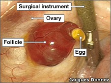 ovulácia