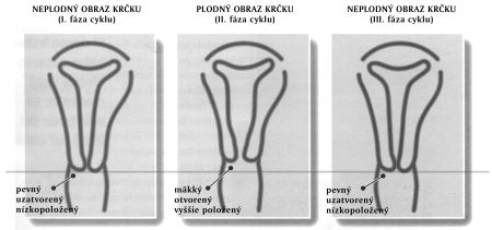 krcokobr