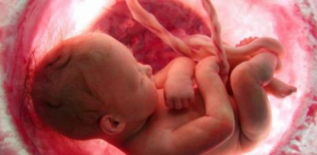 un baby ultrasound petition